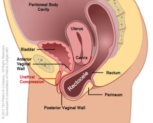 39. Incontinencia urinaria, prolapso genital, trastornos del piso pélvico