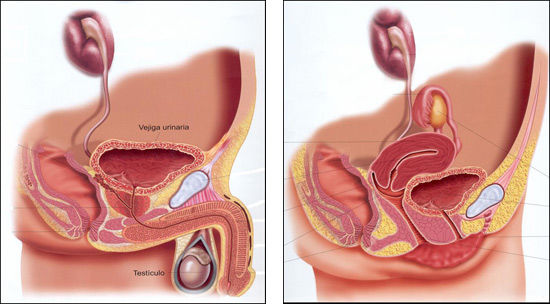 39. Incontinencia urinaria, prolapso genital, trastornos del piso pélvico