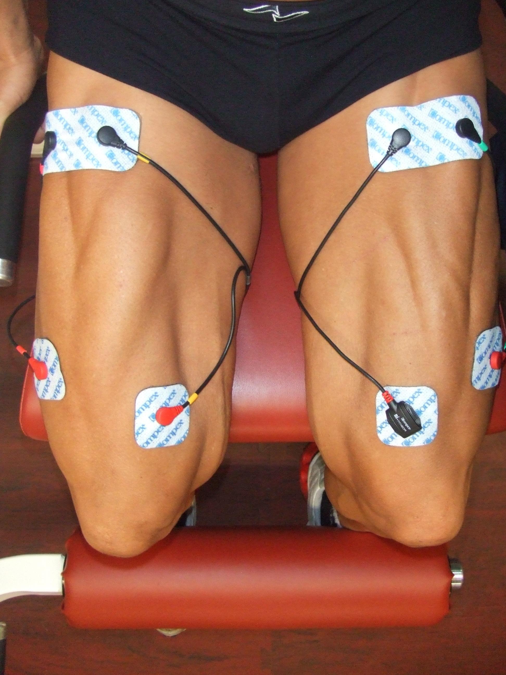 TEMA 4. ELECTROESTIMULACIÓN NEUROMUSCULAR CON CORRIENTES DE BAJA Y MEDIA FRECUENCIA