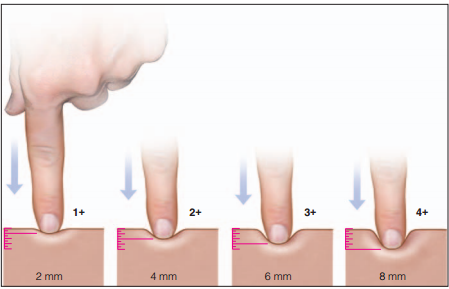 TEMA 4. ELECTROESTIMULACIÓN NEUROMUSCULAR CON CORRIENTES DE BAJA Y MEDIA FRECUENCIA