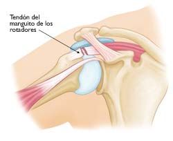 Trauma acumulativo