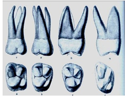 SEGUNDO Y TERCER MOLAR SUPERIOR PERMANENTE