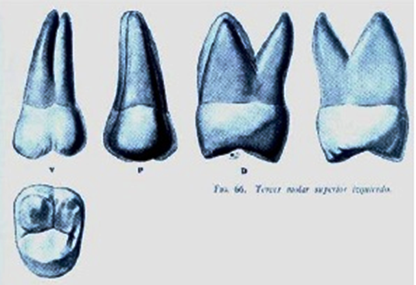 SEGUNDO Y TERCER MOLAR SUPERIOR PERMANENTE