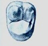 SEGUNDO Y TERCER MOLAR SUPERIOR PERMANENTE