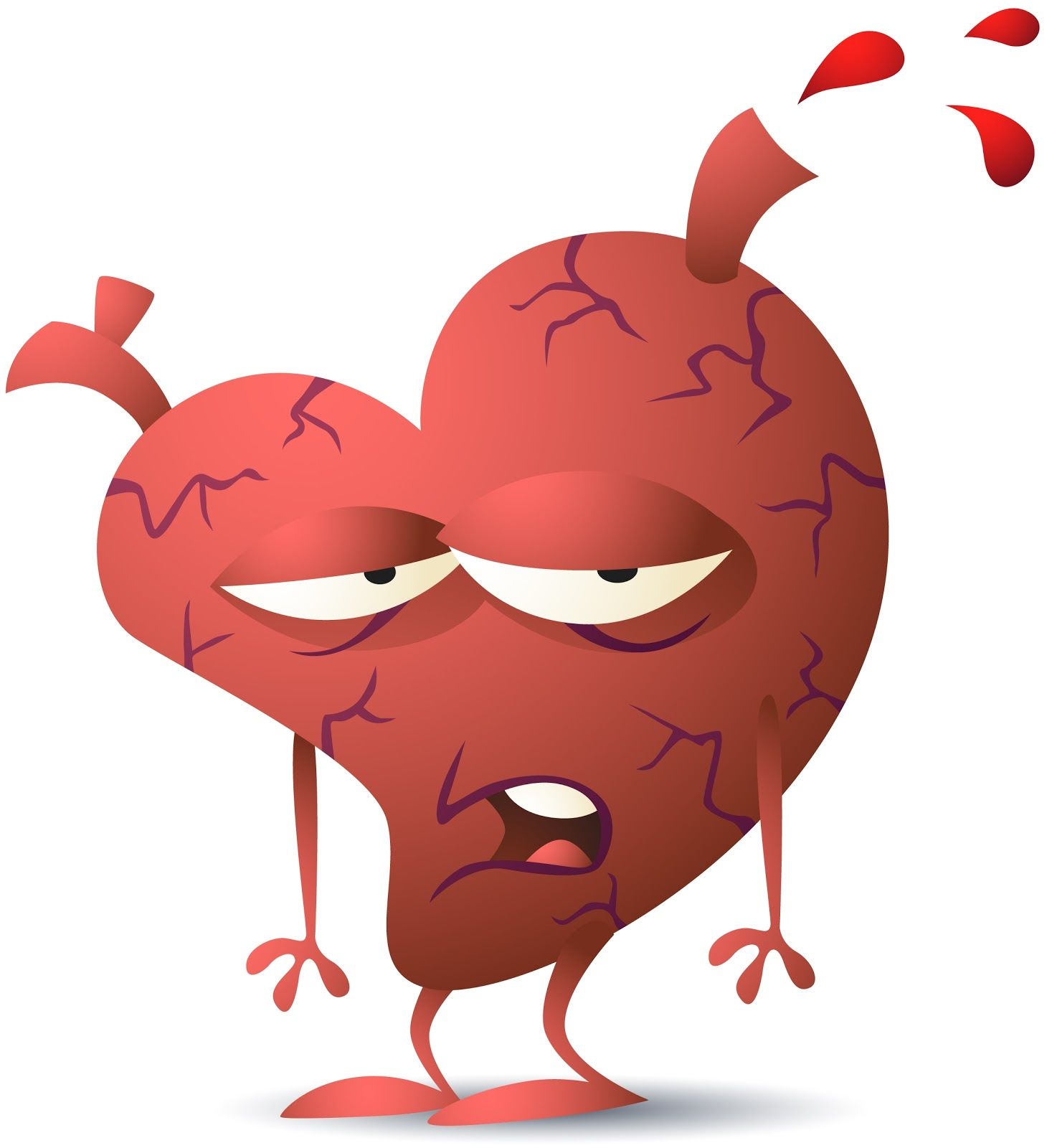 HEART FAILURE (HF): CLINICAL SYNDROME INVOLVING IMPAIRED CARDIAC PUMPING/ FILLING (HAYES, 2015)