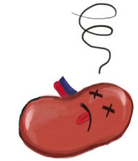 HEART FAILURE (HF): CLINICAL SYNDROME INVOLVING IMPAIRED CARDIAC PUMPING/ FILLING (HAYES, 2015)