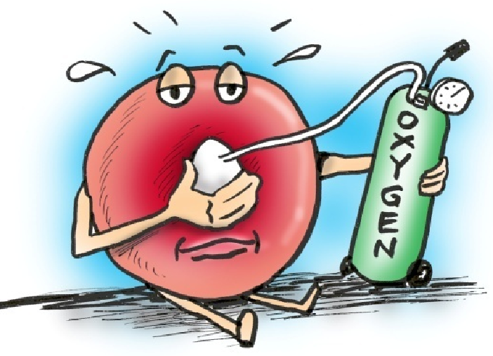 HEART FAILURE (HF): CLINICAL SYNDROME INVOLVING IMPAIRED CARDIAC PUMPING/ FILLING (HAYES, 2015)