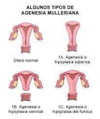 Anomalias Congenitas del Aparato Reproductor Femenino