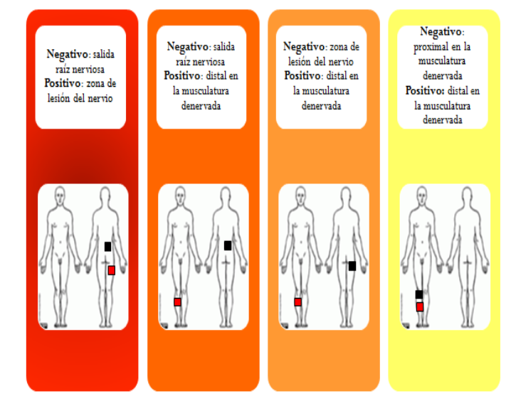 ELECTROESTIMULACION MUSCULAR