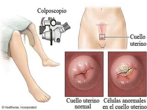 Principios, deberes y derechos de la salud sexual y reproductiva en colombia
