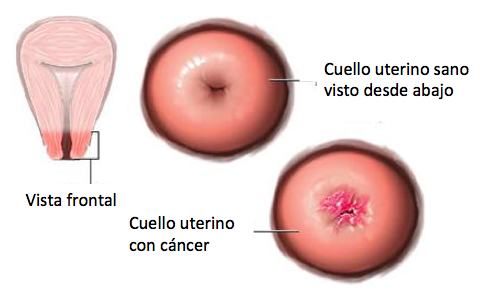 Lineas de accion del estado para trabajar la salud sexual y reproductiva