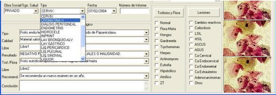 Recepción de frascos,Matriculación de pedidos, Codificación para frascos y pedidos de exámenes Histopatológicos