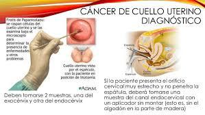 Acción del Estado para Trabajar la Salud Sexual y Reproductiva
