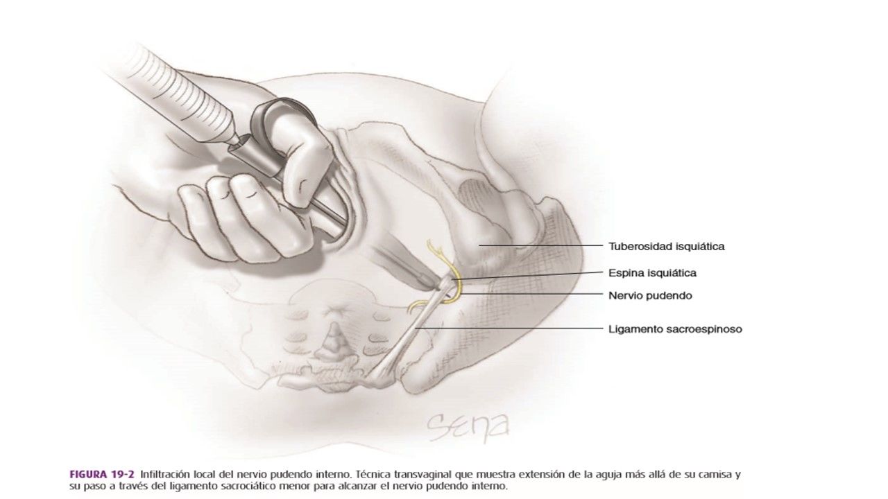 Sesión 10: Analgesia y anestesia obstétrica. Materiales de Sutura