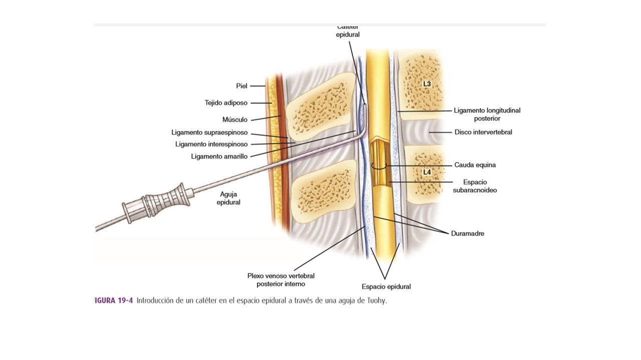 Sesión 10: Analgesia y anestesia obstétrica. Materiales de Sutura