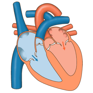 Image for option B