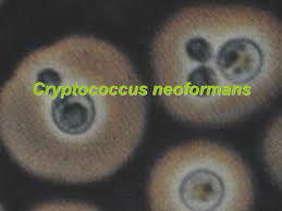 Image for option C