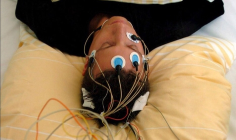 ¿Qué es el electroencefalograma?