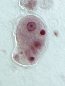 ENTAMOEBA HISTOLYTICA