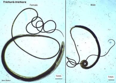 TRICHURIS TRICHURA