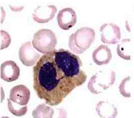 eosinofilo
