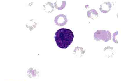 MEGACARIOBLASTO