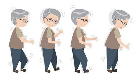 Enfermedades neurodegenerativas