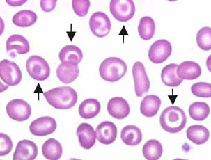 Codocitos (células diana)