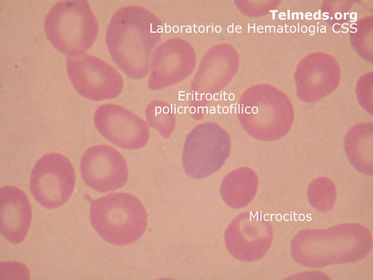Eritrocito policromatofílico