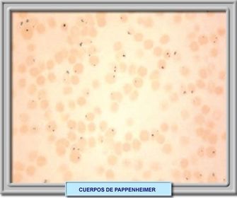 Cuerpos de Pappenheimer