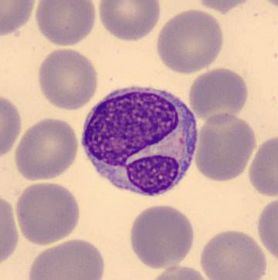 Linfocitos con mitosis o binucleados