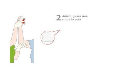 ACTUACIÓN EN HERIDAS PASO A PASO