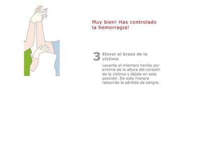 ACTUACIÓN EN HERIDAS PASO A PASO