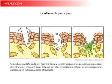 Presentación Wobenzym