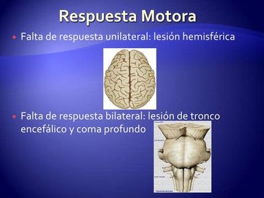 FALTA DE RESPUESTA UNILATERAL