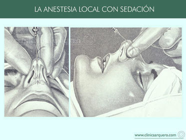 EFECTOS DE LA SEDACIÓN Y ANALGESIA