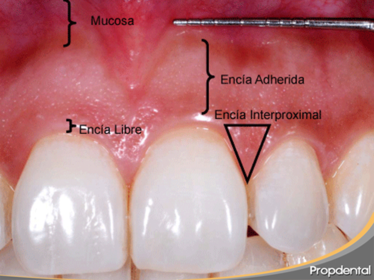 Presentación " EPIDEMIOLOGÍA DE LA ENFERMEDAD PERIODONTAL. "
