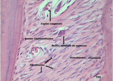 Elementos celulares de el ligamento.