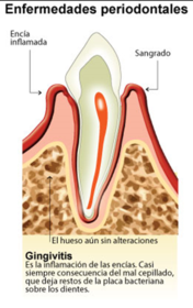 Presentación " EPIDEMIOLOGÍA DE LA ENFERMEDAD PERIODONTAL. "