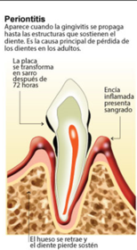 Presentación " EPIDEMIOLOGÍA DE LA ENFERMEDAD PERIODONTAL. "
