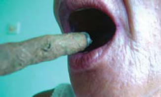 Presentación "EPIDEMIOLOGÍA DEL CÁNCER BUCAL".