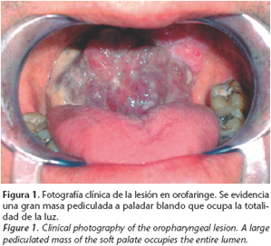 Presentación "EPIDEMIOLOGÍA DEL CÁNCER BUCAL".