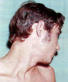 Presentación "EPIDEMIOLOGÍA DEL CÁNCER BUCAL".