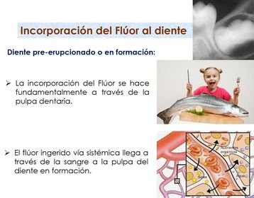 Presentación: Fluoruros y salud bucal