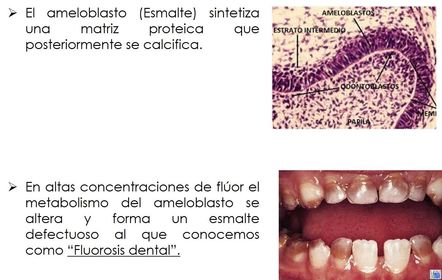 Presentación: Fluoruros y salud bucal