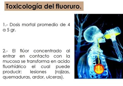 Presentación: Fluoruros y salud bucal