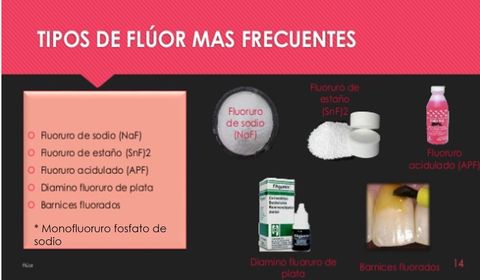 Presentación: Fluoruros y salud bucal