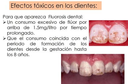 Presentación: Fluoruros y salud bucal