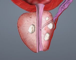 Image for question 9